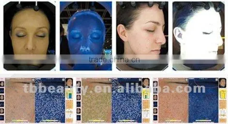 beauty equipment facial skin analysis skin test