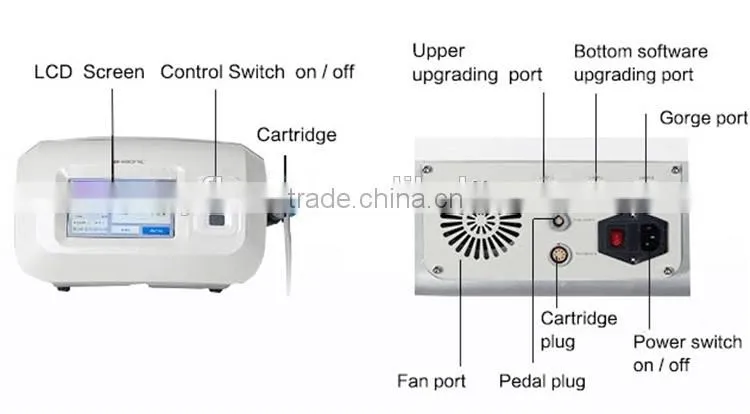 New Sex Vaginal Tightening Technology release woman private parts care / HIFU vaginal tightening beauty machine