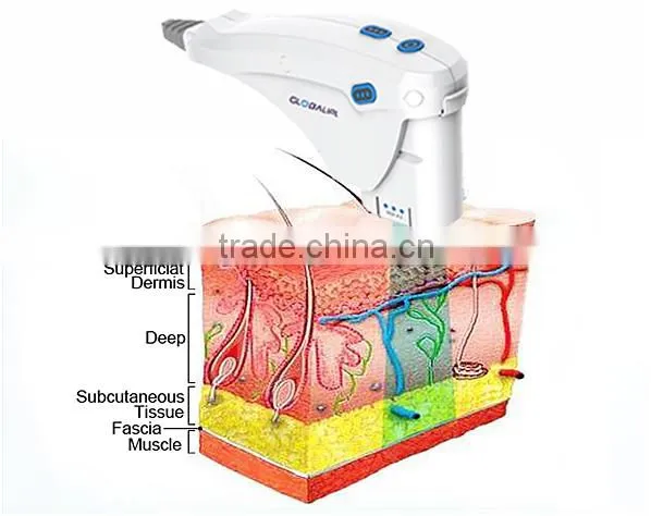 high intensity focused ultrasound surgery of the future