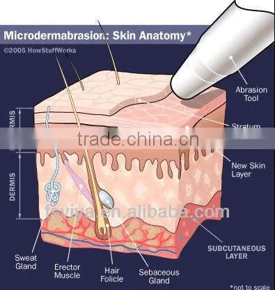 VY-900A Newest Crystal And Diamond Microdermabrasion Peel Beauty Machine