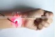 Low power fiber diode laser therapy laser for Tinnitus, Rhinitis