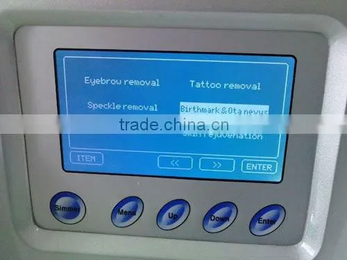Q-switched Nd:YAG Laser for toenail fungus