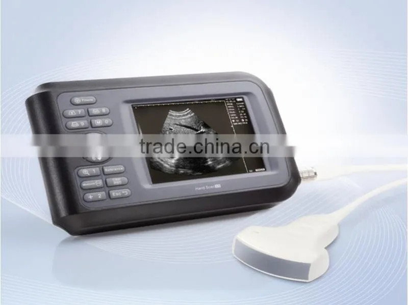 CE/ISO approved palm ultrasound machine Frequency 2.5MHZ-7.5MHZ
