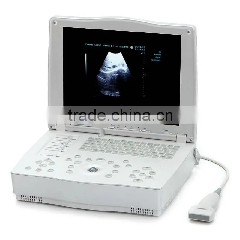 2016 new 15-inch Laptop Ultrasound Scanner with low price