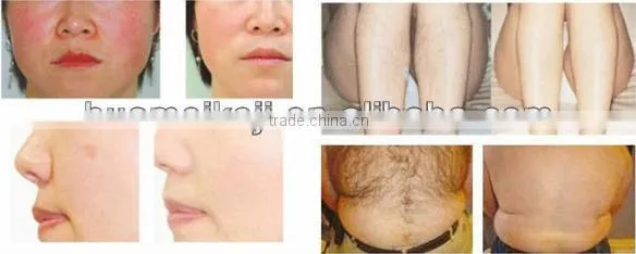 the newest beauty machine global welcome