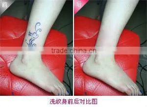 2016 Hot sale ND Yag Laser Tattoo Removal Beauty Machines