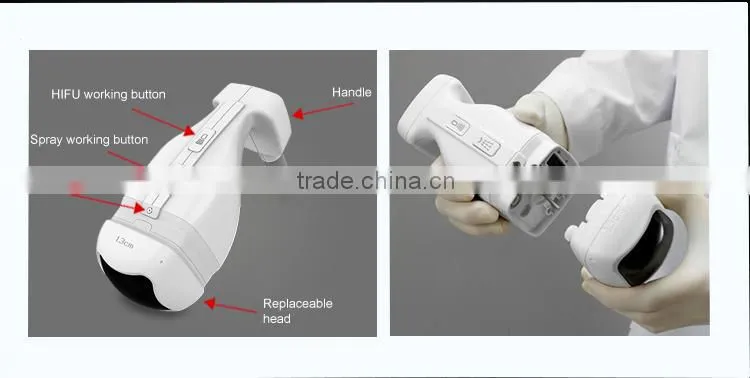 High quality fat reduction 2016 hifu liposonix fat slimming machine hifu liposonix in usa