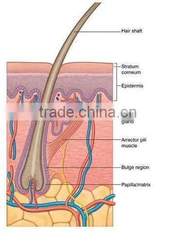 IPL Hair Removal, Permanent Hair Reduction