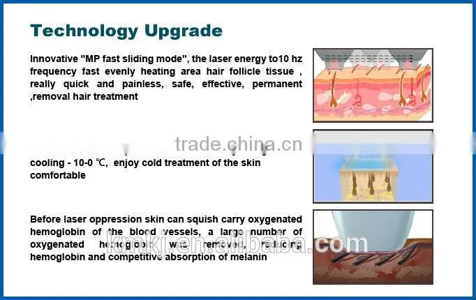 2017 Professional diode laser soprano hair removal machines