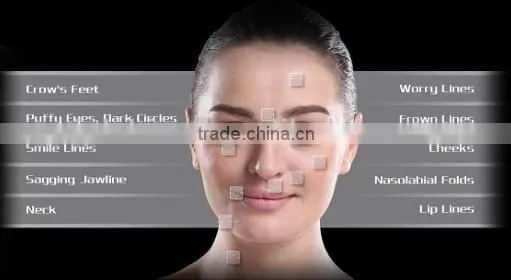 IBelle Shock Wave+Radio Frequency For Skin Lifting & Body Cellulite Loss