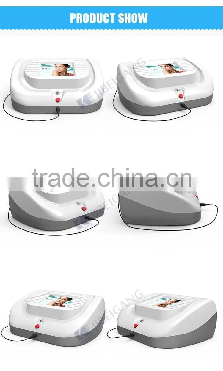 CE approved high frequency 30 MHz RBS laser spider vein removal machine for sale