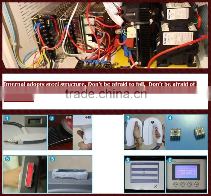 Unique Feature OPT SHR/IPL/LASER Multifunction Hair Removal Machine