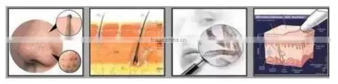 Face Lifting Skin Peeling Facial Bubble Machine Skin Rejuvenation
