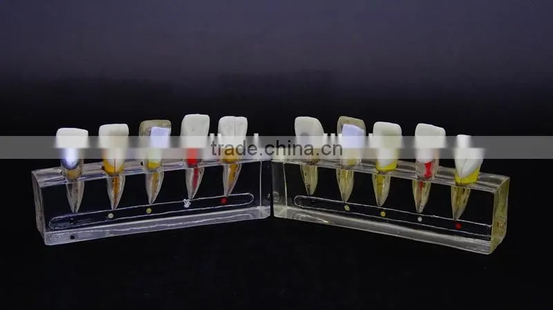 Endodontics disease dental demonstration model 1 DEA-49