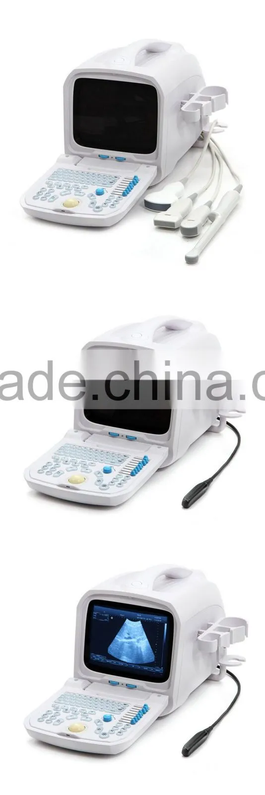 China portable medical Gynecology 10 inch ultrasound machine / equipment price
