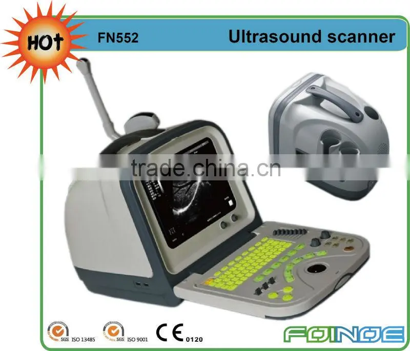 FN660 CE approved digital ultrasonic diagnostic imaging system