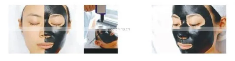 1064 532nm pigmentation removal tatoo removal nd yag laser machine prices