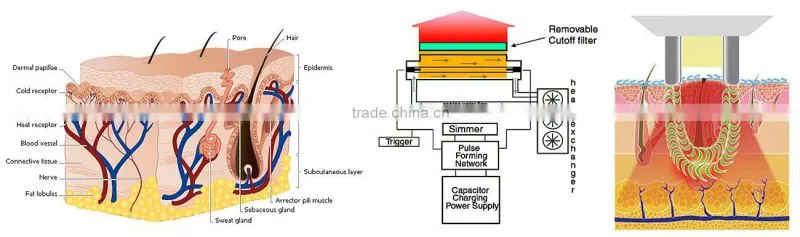 Best selling! ipl skin rejuvenation system