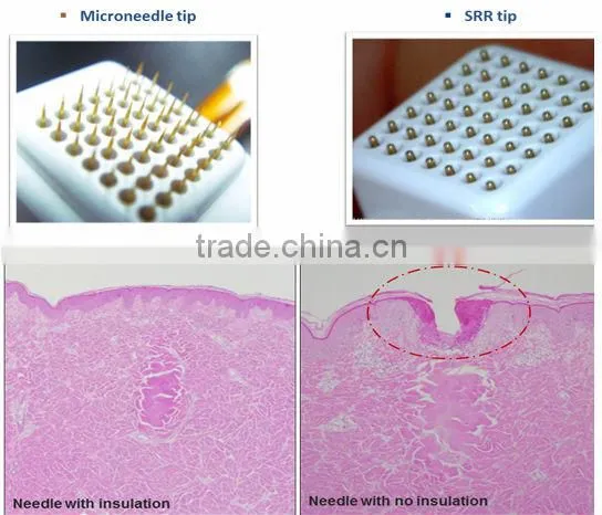 Personal care and beauty series product fractional rf skin lifting machine