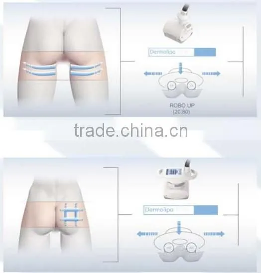 2014 Home Use Beauty Equipment For Skin Beauty & Wrinkle Removal - Cellactor