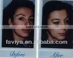 VY-900A Newest Crystal And Diamond Microdermabrasion Peel Beauty Machine