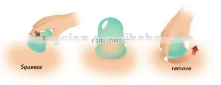 high quality cellulite silicone vacuum suction cup