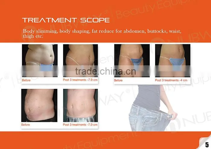 Liposonix HIFU body slimming machine cellulite reduction beauty equipment