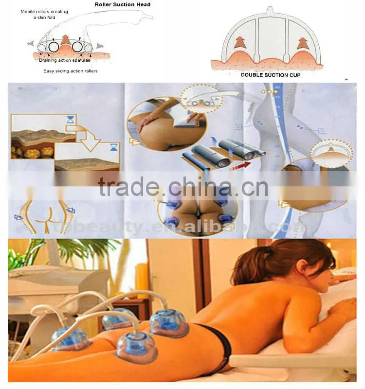 4*double suction cup vacuum cup vacuum therapy physiotherapy