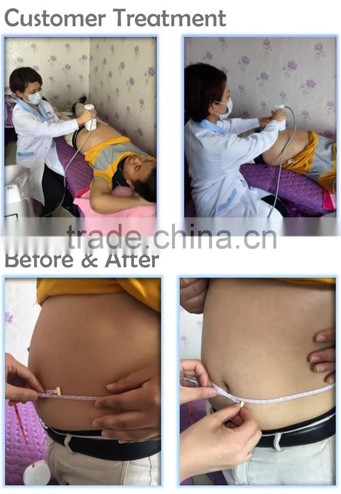 2016 Effective Weight Loss Body Shaping 8mm 13mm HIFU Body Slimming Machine