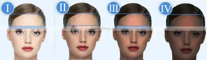 factory OEM 808 diode laser hair removal machine/depilation/professional hair removal 808