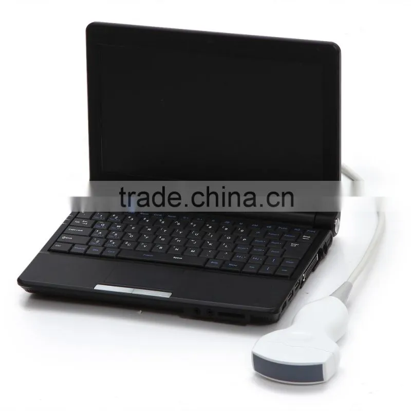 CE approved Laptop Ultrasound Scanner RUS-9000F with 3.5Mhz convex probe and 7.5Mhz linear probe