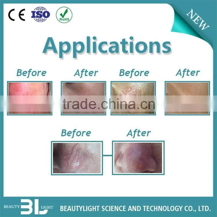 Professional portable beauty equipment with CE certificate