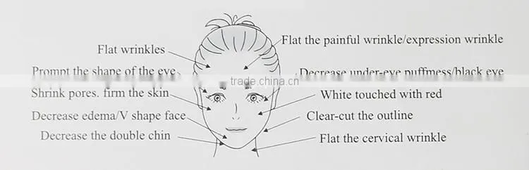 Wholesale portable fashional 1mhz homeuse fractional radiofrequency skin resurfacing device