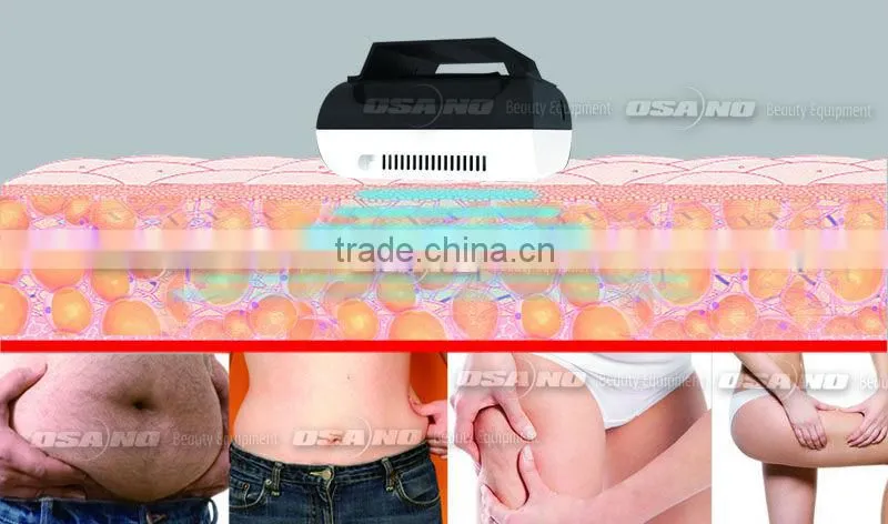 2016 Slimming machine like cryo slim fast freeze home use