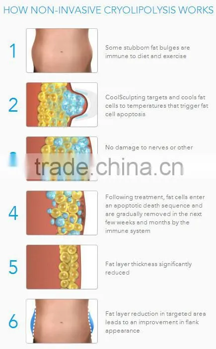 Fat Cavitation Device For Home/Weight Loss Machine/RF--Pro Cryolipo