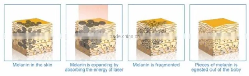 Newest design beauty equipment Q-switched ND YAG laser eyeliner washing tattoo removal laser