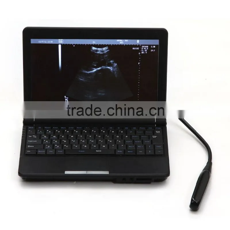 CE & ISO qpproved Laptop Ultrasound Scanner for vet use with low price