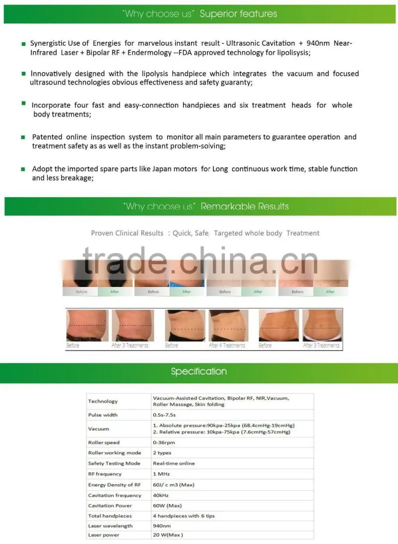 Slimming Machine Cavitation Vacuum Liposuction