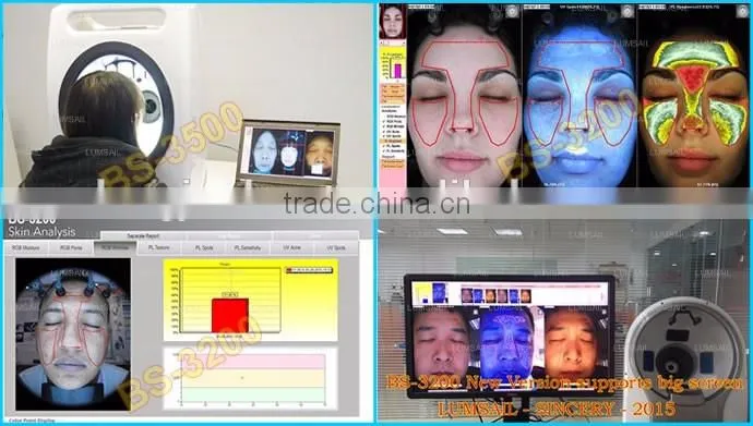 portable face analysis machine BS-3200 bia skin analyzer machine