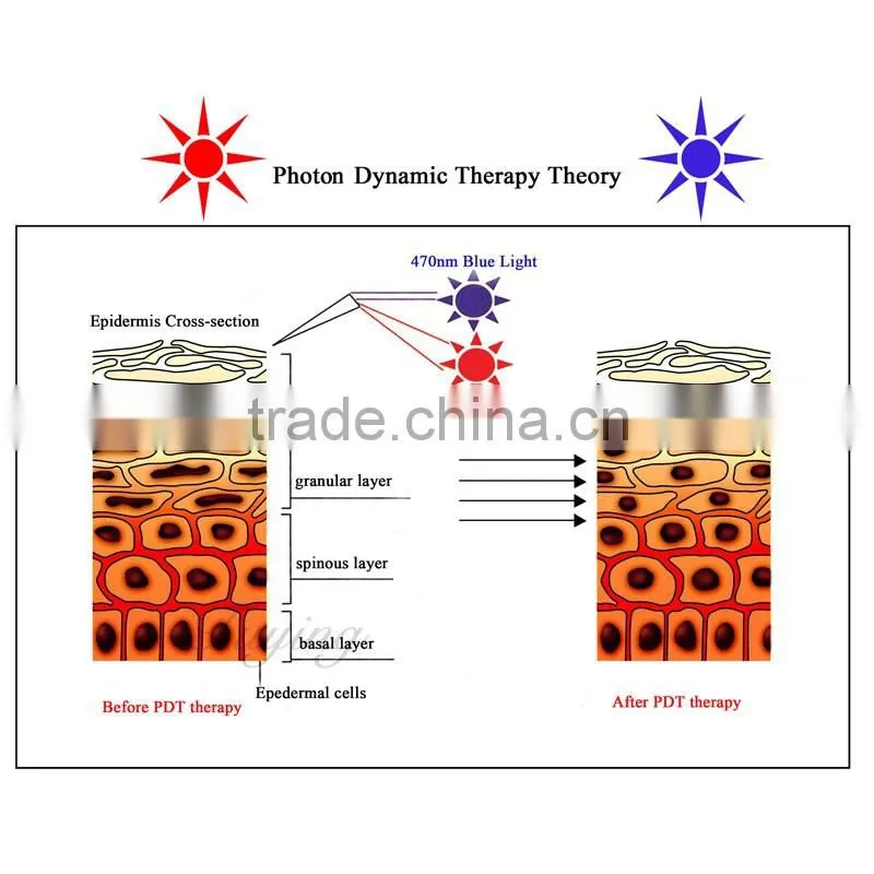 Hot sale Professional 7 Colors Photon LED Skin Rejuvenation PDT Beauty Machine