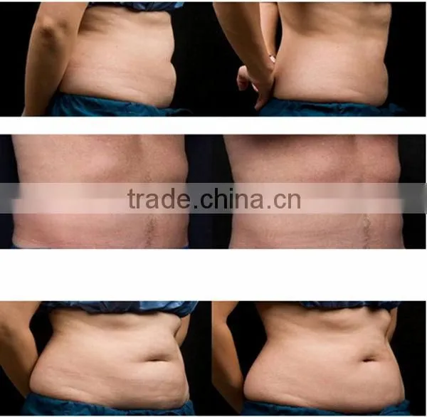 Factory direct sale! 5 in 1 multifunctional slimming device cavitation radio frequency slimming
