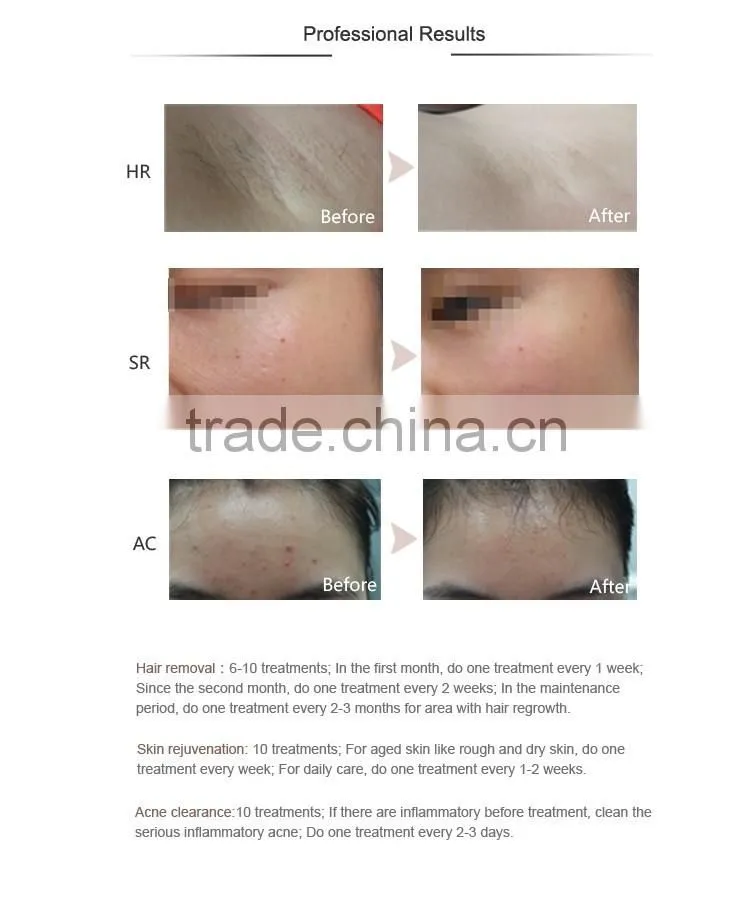 facial instruments beauty personal care beauty treatment machine ipl photofacial machine