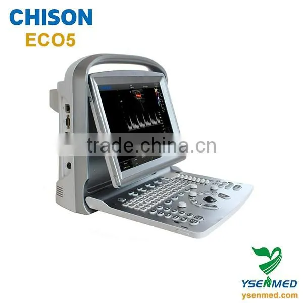 ECO2 high image quality good price black and white portable ultrasound Chison