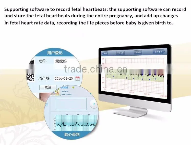 CE/ISO/FDA Approved Medical High Quality Fetal Doppler