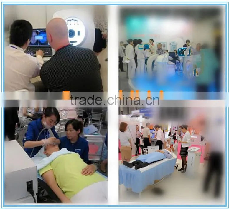 high power 808nm hair removal machine diode laser