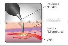 factory price best beauty device / facial veins removal / varicose vein treatment equipment