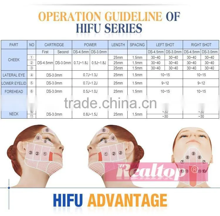 Best Selling Products High Intensity Focused Ultrasound Hifu Facial Lifting Anti Wrinkle With Hifu Cartridge