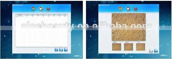ELOS 3S 3 in 1 Skin Analyzer