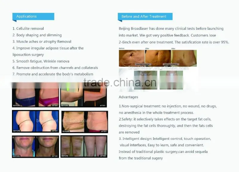 Best effect Ultrasonic cavitation slimming machine vacuum rf body shaping lift Velashape