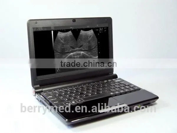 medic training teaching B Mode laptop Ultrosound Scanner machine 7.5MHz probe